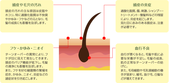 頭皮トラブルを考える